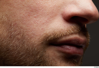 HD Face Skin Erling bearded cheek face facial hair lips…